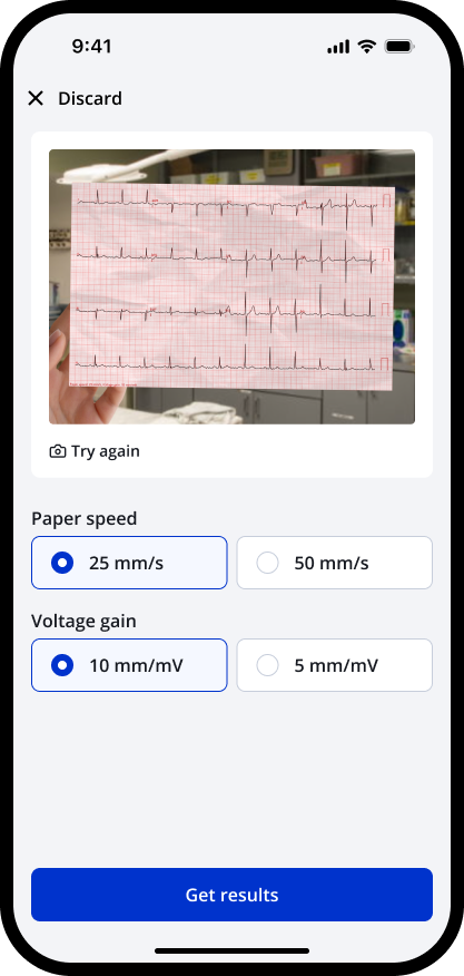 The new-report screen with the paper speed and voltage gain settings