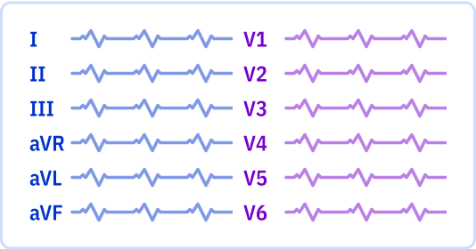 ECG layout: 1 page, 6x2 leads