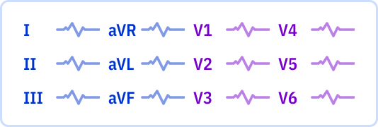 ECG layout: 1 page, 3x4 leads