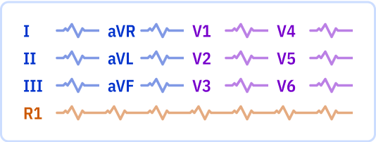 ECG layout: 1 page, 3x4 leads + Rhythm lead