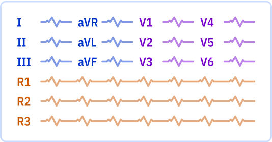 ECG layout: 1 page, 3x4 leads + 3 Rhythm leads