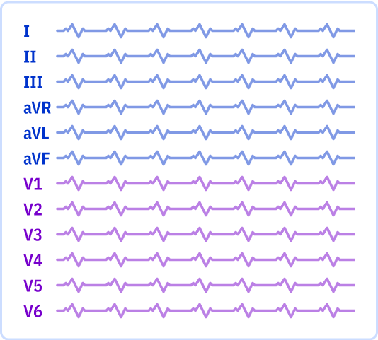 ECG layout: 1 page, 12x1 leads