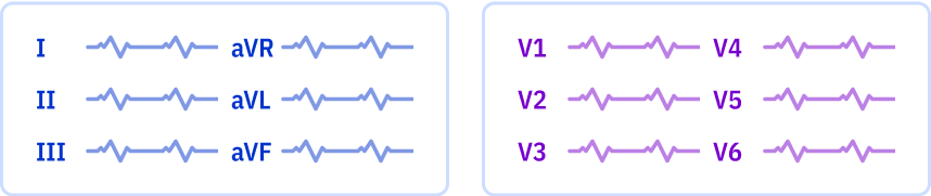 ECG layout: 2 pages, 3x2 leads