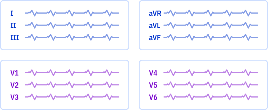 ECG layout: 4 pages, 3x1 leads